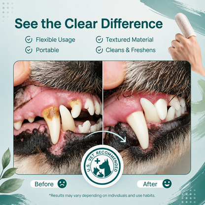 Effix™ Dental Finger Wipes